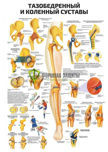 Плакат «Тазобедренный и коленный суставы» от интернет-магазина Формула Защиты