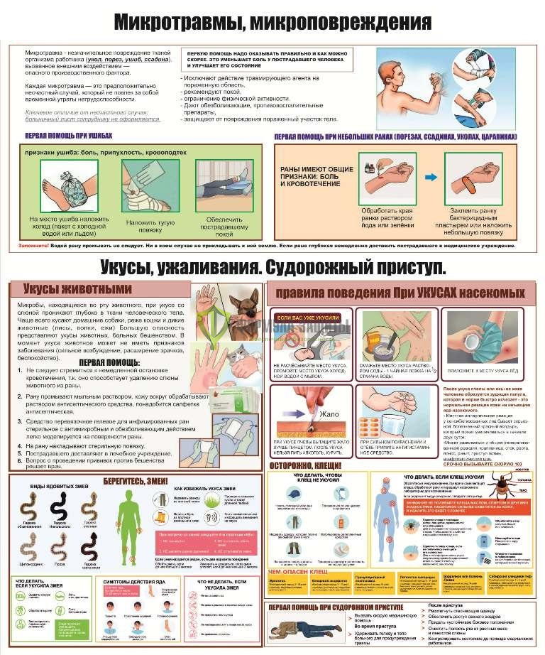 Стенд "Микротравмы, микроповреждения" (размер: 1000x1200 мм) от интернет-магазина Формула Защиты